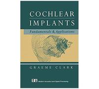 Cochlear Implants
