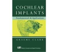 Cochlear Implants: Fundamentals and Applications Clark, Graeme (Auteur)
