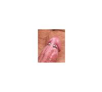 Cockring en métal en acier avec des anneaux résistants