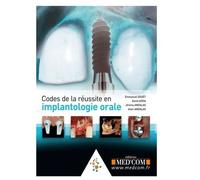 Codes De La Réussite En Implantologie Orale