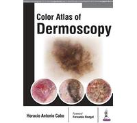 Color Atlas Of Dermoscopy