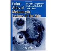 Color Atlas Of Melanocytic Lesions Of The Skin