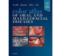 Color Atlas of Oral and Maxillofacial Diseases, 1e - [Version Originale] Inconnu (Auteur)