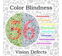 Color Blindness Vision Defects with Numbers White Background: Blind Test Protanomaly Protanopia Deuteranomaly Deuteranopia Tritanomaly Tritanopia Achromatomaly Achromatopsia
