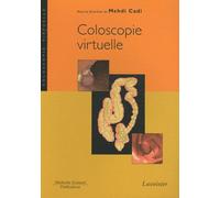 Coloscopie Virtuelle