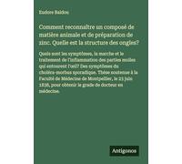 Comment reconnaître un composé de matière animale et de préparation de zinc. Quelle est la structure des ongles?: Quels sont les symptômes, la marche ... l'oeil? Des symptômes du choléra-morbus