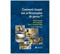 Comment Réussir Ses Arthroscopies De Genou ?