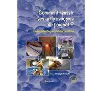 COMMENT REUSSIR SES ARTHROSCOPIES DE POIGNET ?