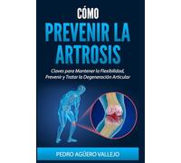 Cómo Prevenir la Artrosis: Claves para Mantener la Flexibilidad Prevenir y Tratar la Degeneración Articular la Artrosis en la Mujer
