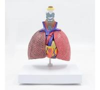Comparaison poumon fumeur et poumon sain avec carte d'instructions丨Modèle cœur-arbre bronchique 5 pièces, outil pédagogique d'anatomie cardiopulmonaire pour la santé respiratoire