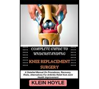 Complete Guide To Understanding Knee Replacement Surgery: A Detailed Manual On Procedures, Recovery, Risks, Alternatives For Arthritis Relief And Joint Health Improvement