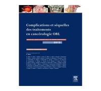 Complications et séquelles des traitements en cancérologie ORL Rapport SFORL 2013 - Frédéric Chabolle - Elsevier Masson - cartonné - Etude