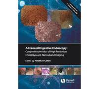 Comprehensive Atlas Of High Resolution Endoscopy And Narrowband Imaging