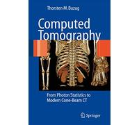 Computed Tomography: From Photon Statistics to Modern Cone-Beam Ct