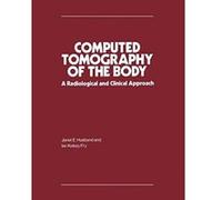 Computed Tomography of the Body: A Radiological and Clinical Approach - [Version Originale] Janet E Husband, Ian Kelsey Fry (Auteur)