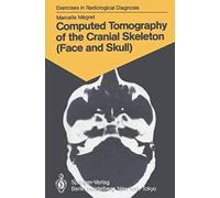 Computed Tomography Of The Cranial Skeleton (Face And Skull)