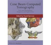 Cone Beam Computed Tomography by D Sarment Paperback Book D Sarment (Auteur)