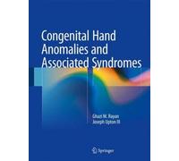 Congenital Hand Anomalies And Associated Syndromes