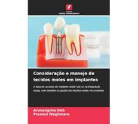 Consideração e manejo de tecidos moles em implantes