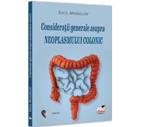 Consideratii generale asupra neoplasmului colonic - Raul Mihailov, Medicina, Editie in limba romana