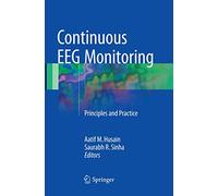 Continuous Eeg Monitoring: Principles and Practice