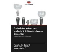 Contraintes autour des implants à différents niveaux d'insertion: Une évaluation photoélastique