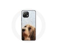 Coque pour Xiaomi Mi 11 Lite Blonde Vulnerable native breeds