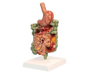 Coupe transversale de l'estomac Modèle d'anatomie du Gros intestin et de l'intestin grêle Modèle pathologique du système digestif for Les étudiants en Formation médicale Étude Affichage
