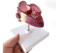 COYEUX Modèle Anatomique du Cœur Canin, Modèle Détachable Illustrant La Pathologie De La Dirofilariose avec Ventricules Et Circulation Sanguine, Support Pédagogique pour Les étudiants en Médecine