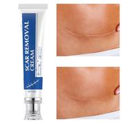 Crème Anti-Cicatrices - 30g Soin Pour Marques De Brûlure | Crème Atténuante Pour Cicatrices Anciennes | Pour Récupération Blessure Chéloïdes Femmes Hommes Athlètes