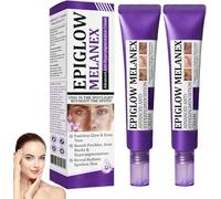 Crème anti-hyperpigmentation avancée, Anti-taches visage et corps, pour le traitement de l'hyperpigmentation