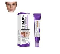 Crème anti-hyperpigmentation avancée Epiglow Melanex de Ceoerty - Crème anti-hyperpigmentation pigmentaire pour le traitement de l'hyperpigmentation et anti-âge, adaptée à tous les types de peau (1)