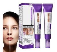 Crème Anti-hyperpigmentation Avancée Epiglow Melanex, Lot de 2 Éliminateur de Taches Brunes, Crème Anti-taches pour le Traitement de L'hyperpigmentation, Hydratant Anti-âge, pour T-ous Types de Peau