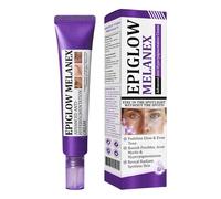 Crème Anti-Taches - Crème Correctrice Visage Contre Les Taches,Correcteur de Pigmentation Faciale Produits de Soins de la Peau pour les Femmes les Épouses les Mères les Grands-mères