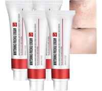 Crème blanchissante anti-taches de rousseur, correcteur de taches brunes pour le visage, hydratant éclaircissant à la niacinamide, crème anti-rides raffermissante au rétinol (4 pièces)