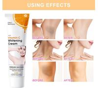 Crème Blanchissante, Underarm Whitening Cream, Skin Lightening Cream, Armpit Whitening Crème, Efficace Pour Les Aisselles, Les Coudes, Blanchit, Nourrit, 50g