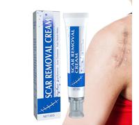 Crème démaquillante pour vergetures - 30 g - Crème d'élimination des vergetures - Crème pour cicatrices chéloïdes - Pour les cicatrices d'hyperplasie, les femmes enceintes