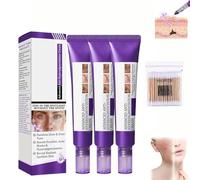 Crème éclaircissante pour le visage avec racine de réglisse et niacinamide, correcteur de teint pour les taches sombres et les marques post-acnéiques, formule douce pour les peaux sensibles (3pcs)