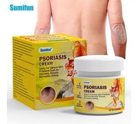 Creme Pour Le Psoriasis, Creme Apaisante Anti-Demangeaisons Pour La Peau, Formule Apaisante Et Calmante, Hydratante Pour Les Rougeurs Et L'inconfort, Traitement Du Psoriasis C 20 G