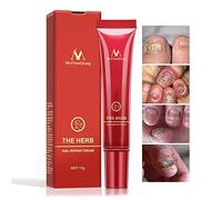 Crème pour les Ongles des Pieds aux Pieds, Protecteur Soins de la Peau Crème Onguent Traitement Ongle Onychomycose Paronychia Traitement Anti Fongique Crème de Réparation des Ongles, 15g