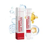 Crème pour les taches de rousseur, crème pour éliminer les cicatrices d'acné, crème pour les taches sombres du visage, crèmes pour éliminer les taches du visage, crème pour éliminer la pigmentation du
