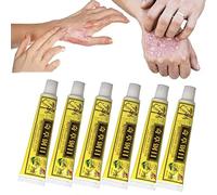 Crèmes Naturelles Chinoises D’eczéma à Base De Plantes, Crème Naturelle à Base De Plantes, Dermatite Et Eczéma Prurit Pommade Psoriasis (6pcs)