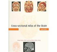 Cross-Sectional Atlas Of The Brain Ion-Florin Talos, Peter Ratiu (Auteur)