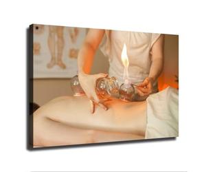 Cupping Treatment Chinese Medicine Spa Poster Modern Minimalist Wall Art Wellness Home