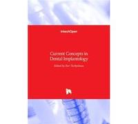 Current Concepts in Dental Implantology - BoD Third Party Titles - BoD Third Party Titles - Livre en Anglais - Hardback BoD Third Party TitlesBoD Third Party Titles (Auteur)