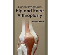 Current Progress In Hip And Knee Arthroplasty
