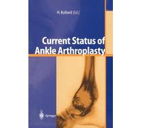 Current Status Of Ankle Arthroplasty