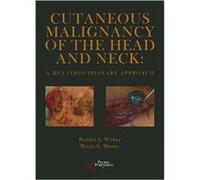 Cutaneous Malignancy of the Head and Neck by Brian A. Moore Brian A. Moore, Randal S. Weber (Auteur)