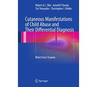 Cutaneous Manifestations of Child Abuse and Their Differential Diagnosis: Blunt Force Trauma