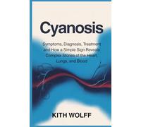 Cyanosis: Symptoms, Diagnosis, Treatment and How a Simple Sign Reveals Complex Stories of the Heart, Lungs, and Blood